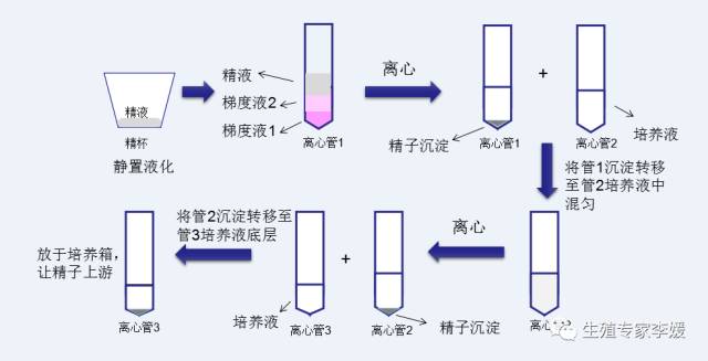 洗精试管婴儿的流程