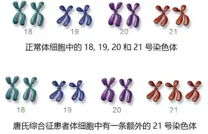 揭秘胚胎18号染色体异常四大原因，遗传问题最为关键