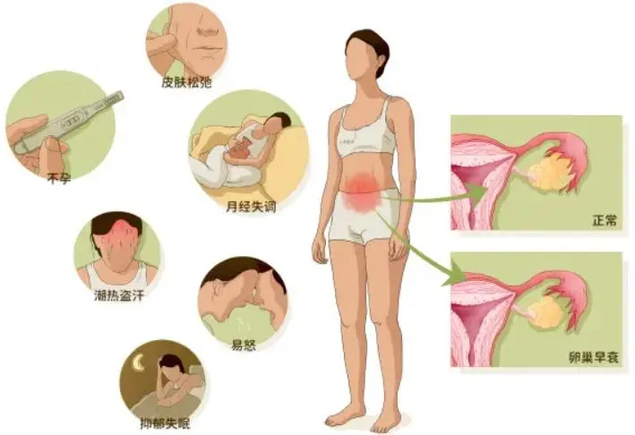 卵巢早衰的8大征兆，严重会直接导致不孕