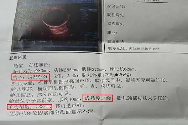 男孩女孩双顶径对照表分享，据说双侧宽度能辨别性别