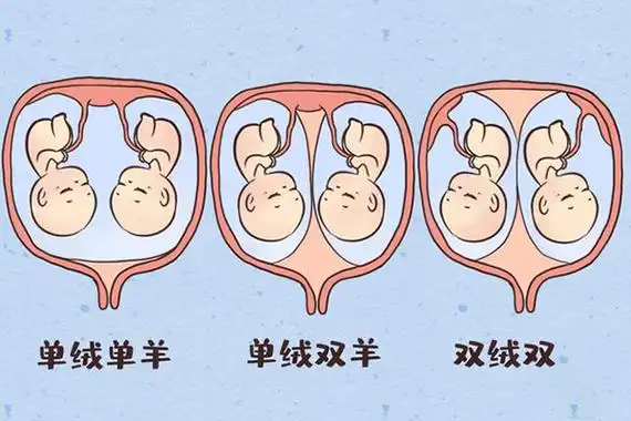 双胞胎是怎么形成的?同卵双胞胎形成原因将通过本文带你弄清原理