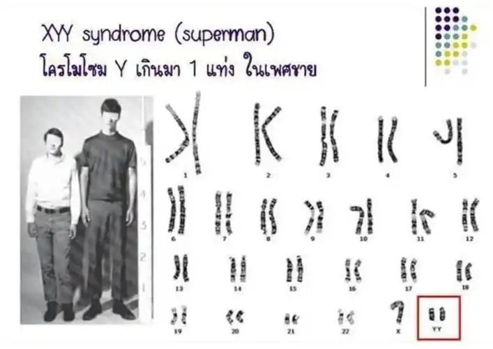 30秒带你深度了解超雄综合症孩子的特点和表现