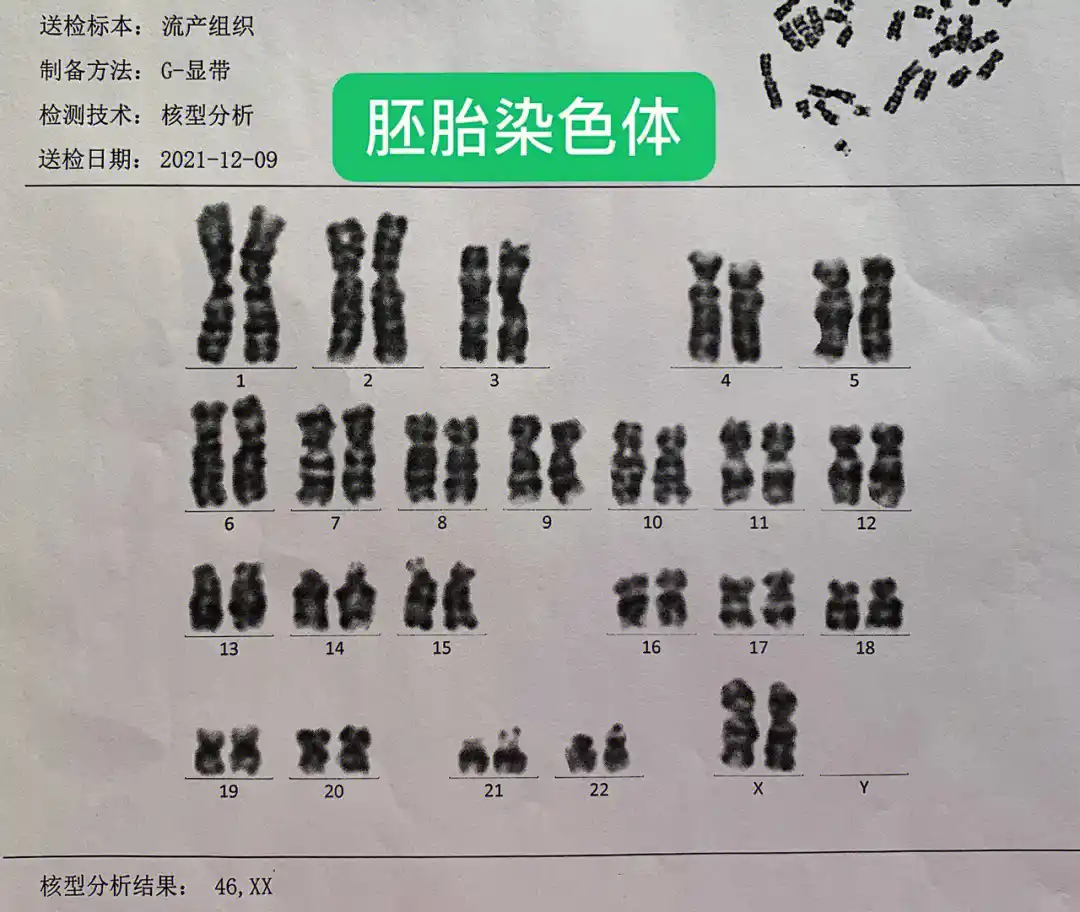 胚胎染色体检查多少钱?来看看郑州各家医院都怎么收费