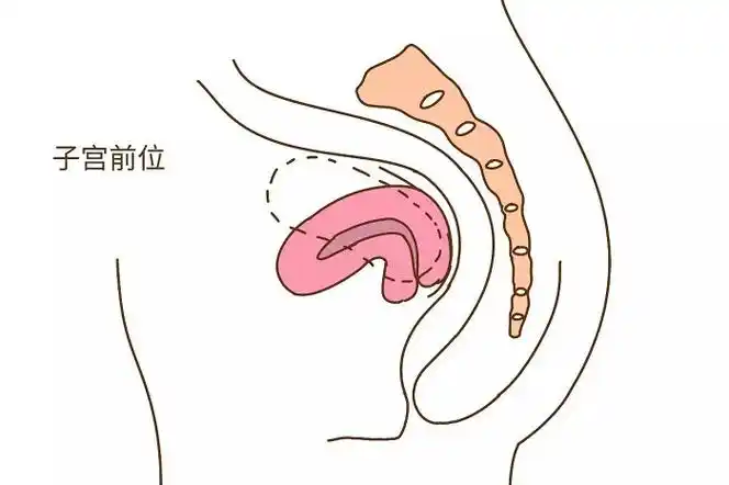 子宫前位容易怀孕吗?来看看网友都是怎么说的