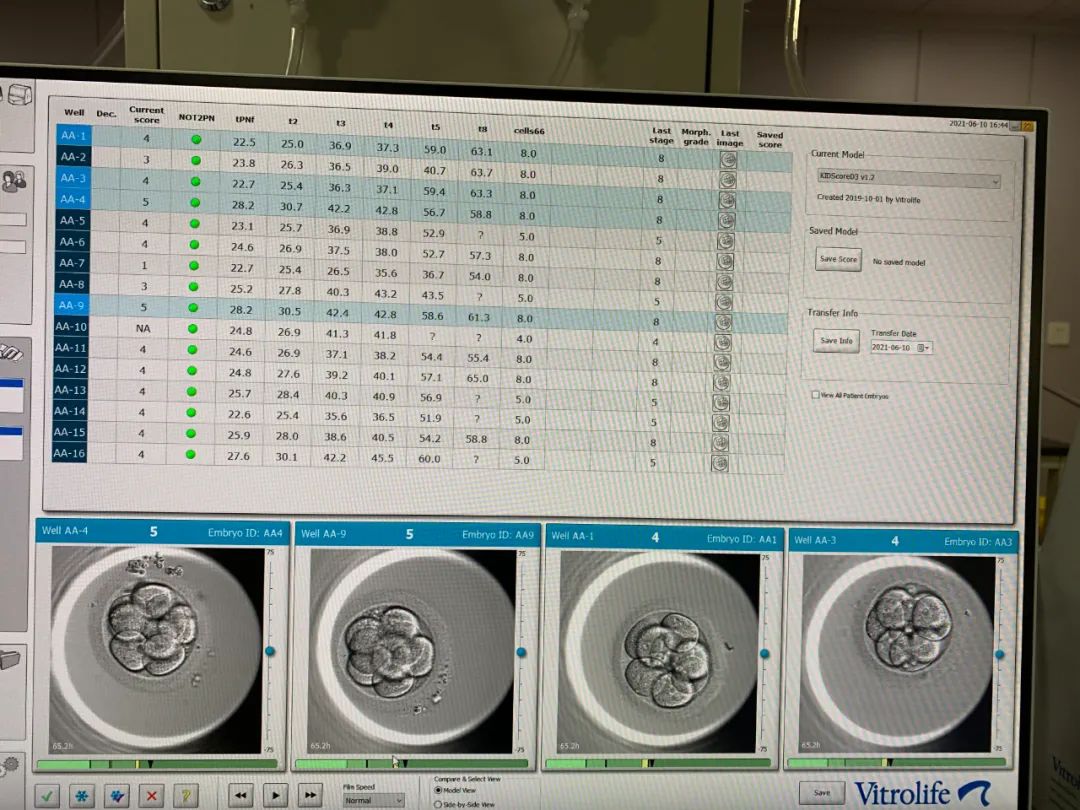 SART基因生殖中心运用PGD技术治疗遗传疾病