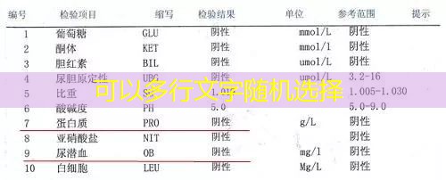 尿常规检查项目示例