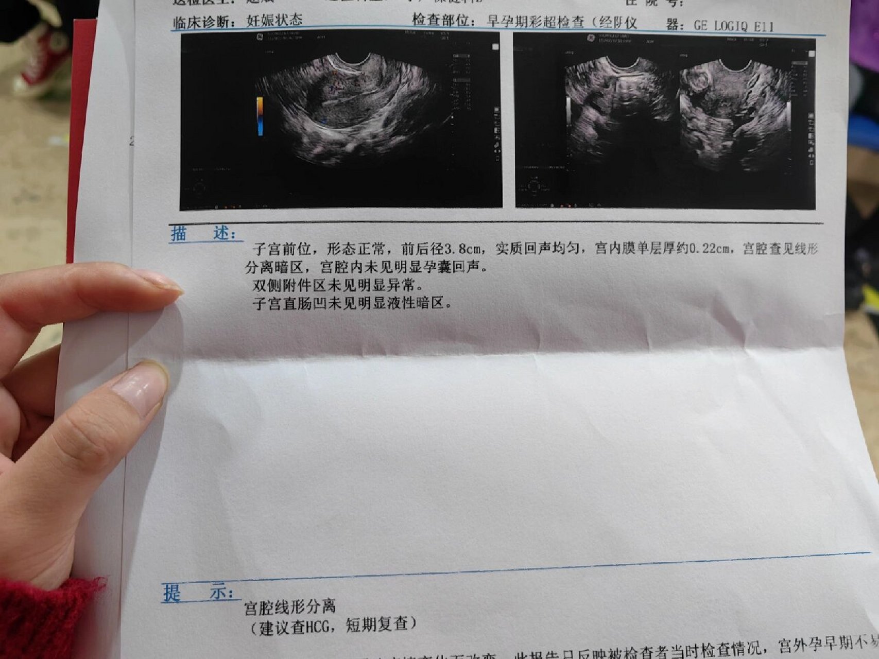 试管婴儿移植后hcg和孕酮低怎么办?调整饮食和作息或许有用